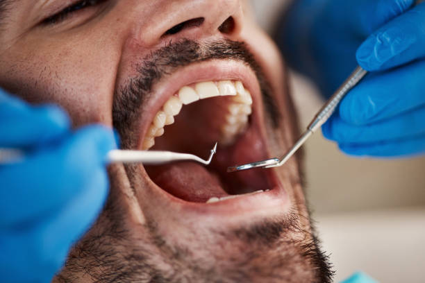 Best Broken or Cracked Tooth Emergency Dentist in Bayside, WI